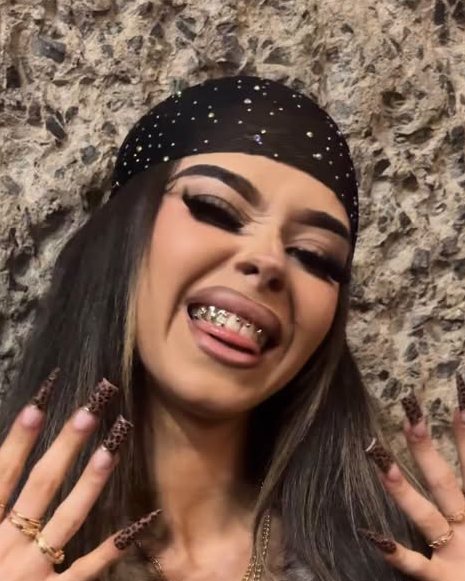 Client smiling to show a gold grill set